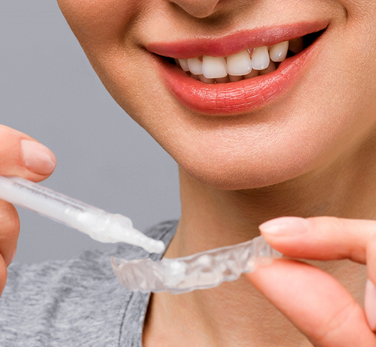Teeth Whitening