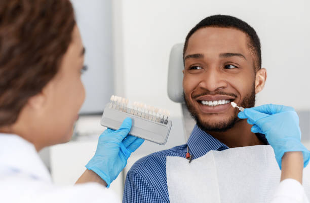 Whitening instructions 22% Concentration