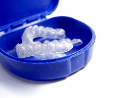 Whitening Instructions: 35% Concentration