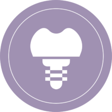 Tooth Implants