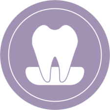 Mouth Guard (Occlusal Guard)