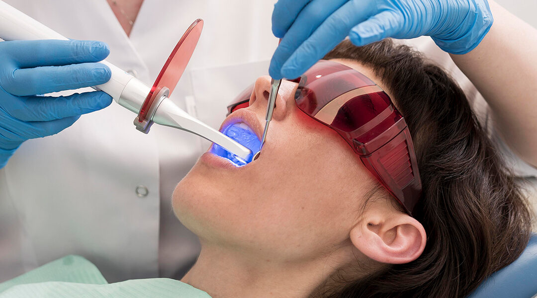 The Benefits of Professional Teeth Whitening: Why Dentistry of Norcross is the Right Choice