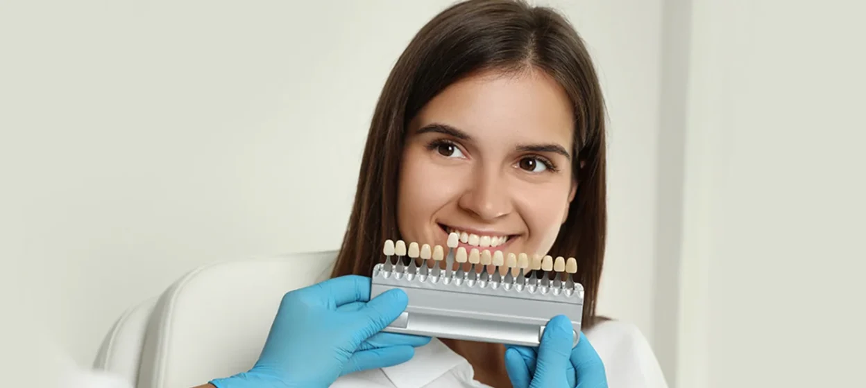 Are Thin Veneers Durable and Long-Lasting?