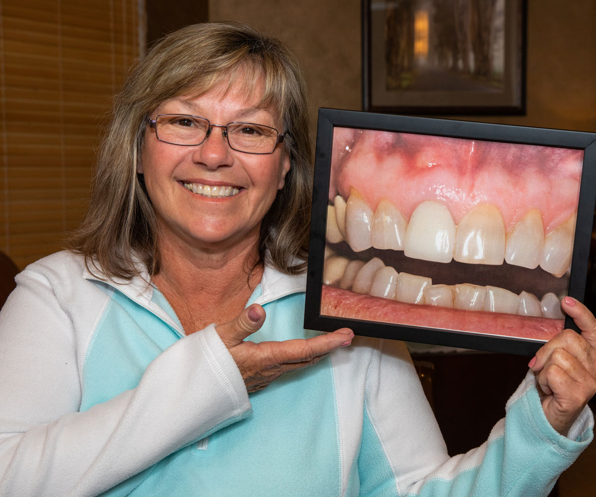 dental implants patient smiling after procedure Tavares, FL