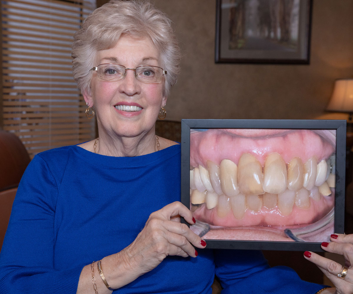 full arch dental implants patient smiling after procedure Tavares, FL