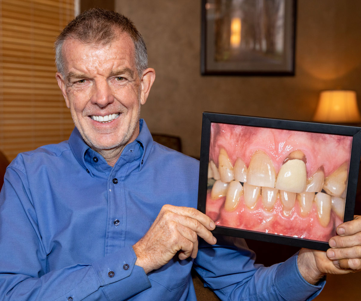 full mouth reconstruction patient smiling Tavares, FL