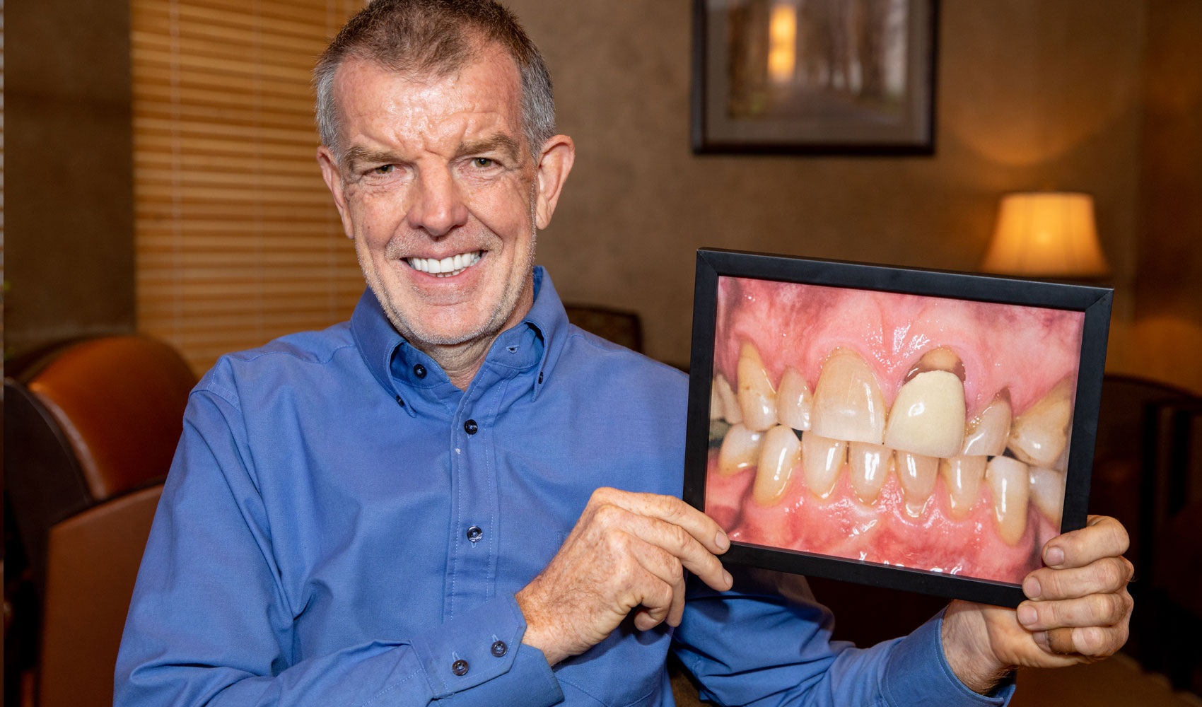 full mouth reconstruction patient smiling Tavares, FL