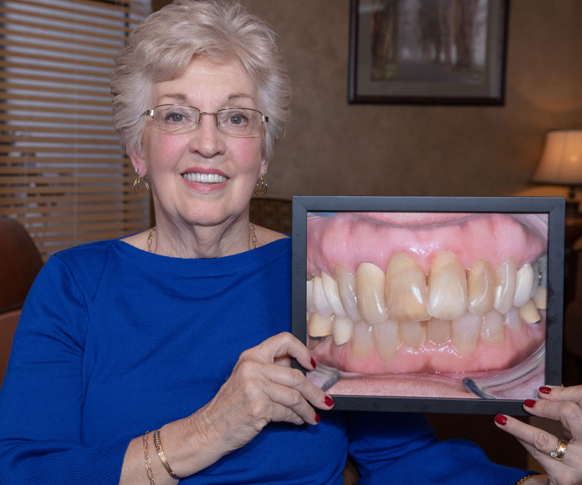 full mouth reconstruction patient smiling Tavares, FL