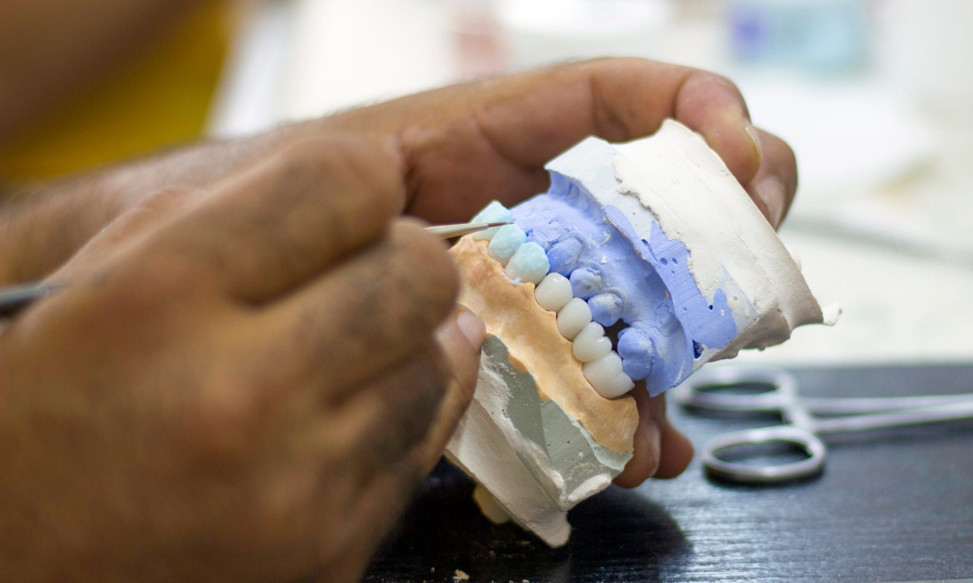 a dentist painting a full mouth all on x dental prosthetic implant model.