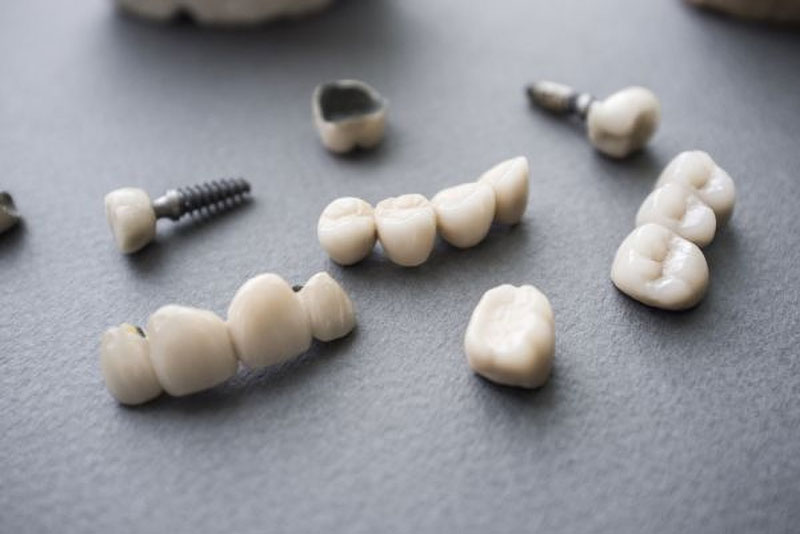 a picture of crowns and bridges prosthetics that can be used to correct patients' smiles. they are sporadically laid out on a black table.