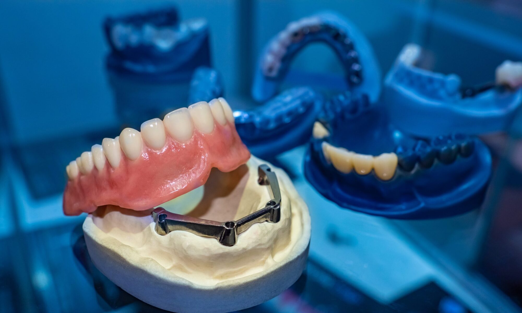 image of a dental implant denture on a prosthesis jaw in a dark and blue aesthetic dental room