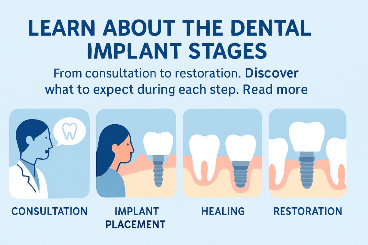 Image illustrating the dental implant stages with an infographic, showing consultation, implant placement, healing, abutment attachment, and final restoration. No text on image.