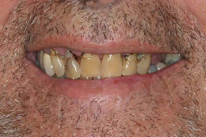 Before