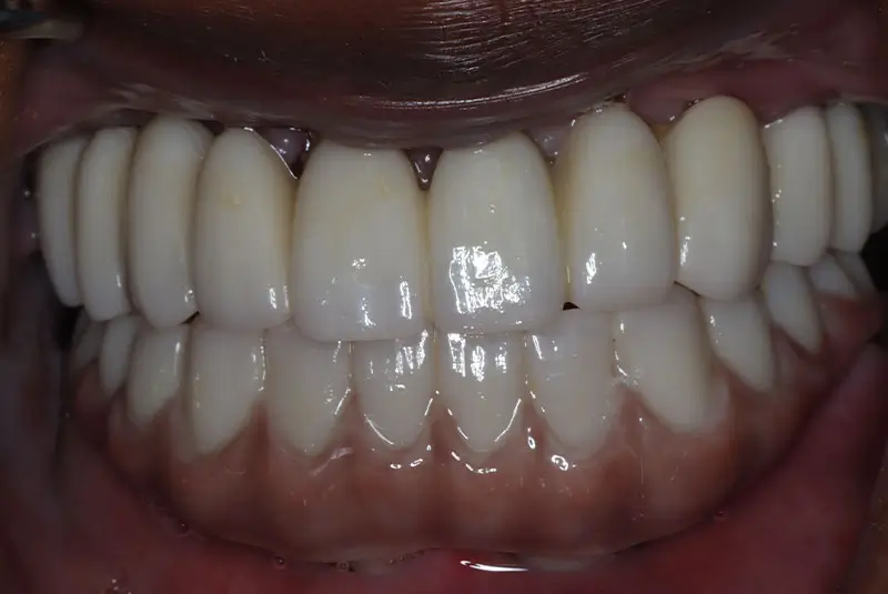 After