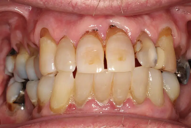 Before