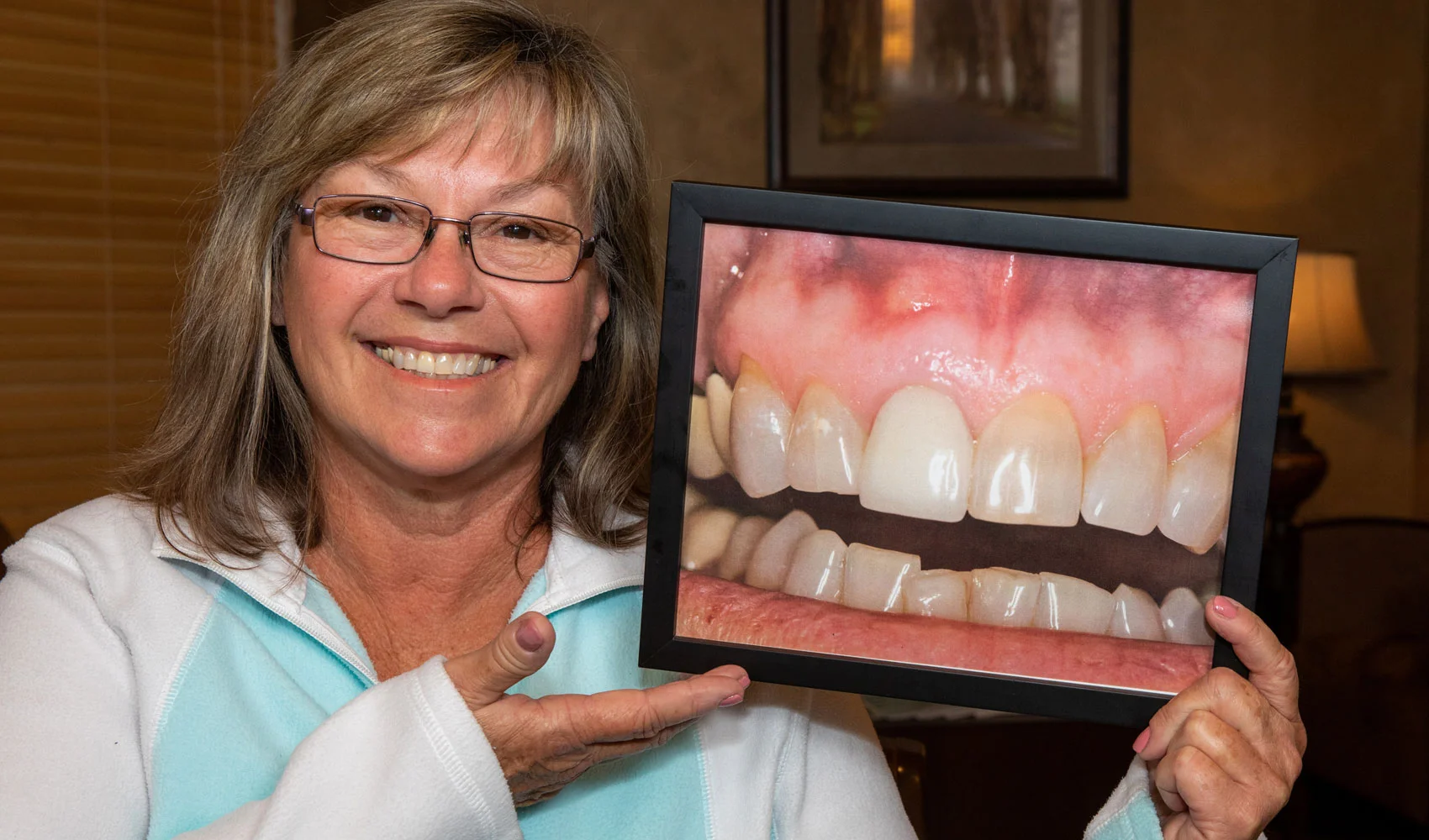 dental implants patient smiling Tavares, FL