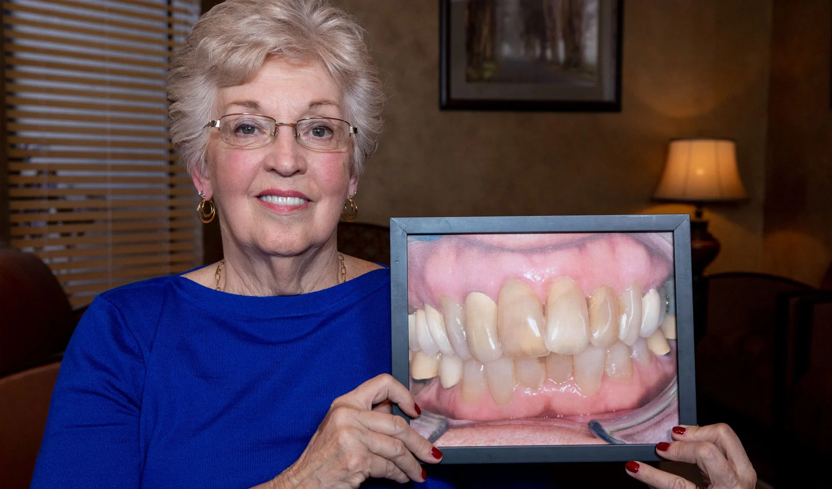 full mouth reconstruction patient smiling Tavares, FL