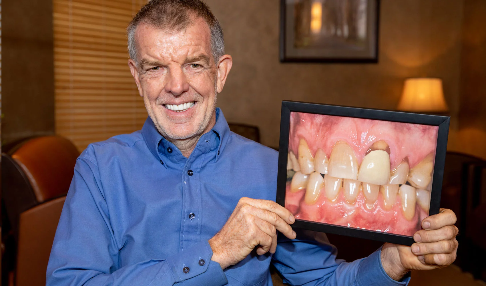 full mouth reconstruction patient smiling Tavares, FL