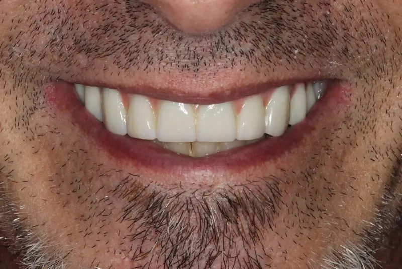 After