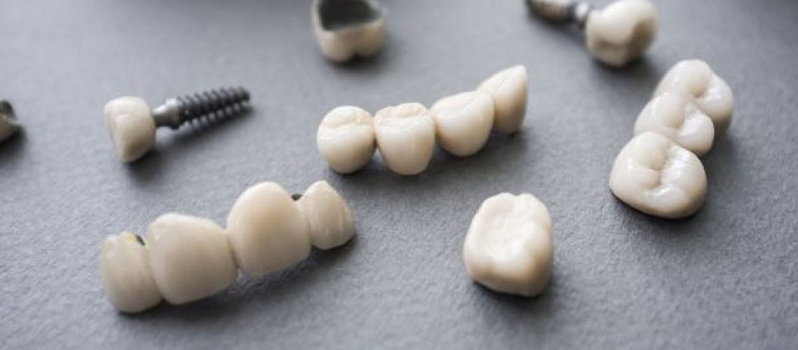 a picture of crowns and bridges prosthetics that can be used to correct patients' smiles. they are sporadically laid out on a black table.