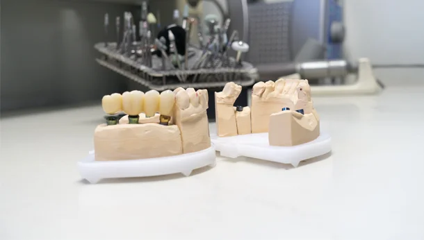 Masterfully Crafted Dental Restorations