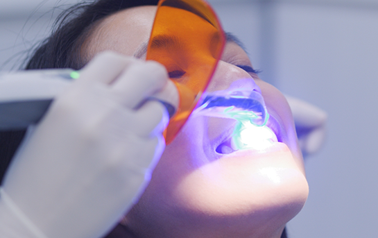 Cosmetic dentist shining an ultraviolet light onto a patients tooth