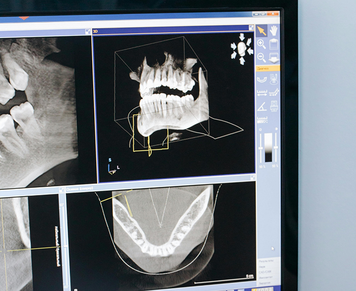 Advanced Dental Technology