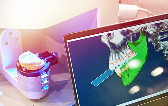 Dental lab device creating a denture based on a model of the teeth on a nearby screen