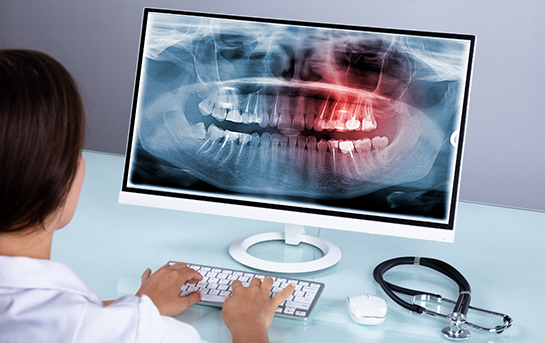 Dentist looking at an x ray of a patients teeth on a computer screen