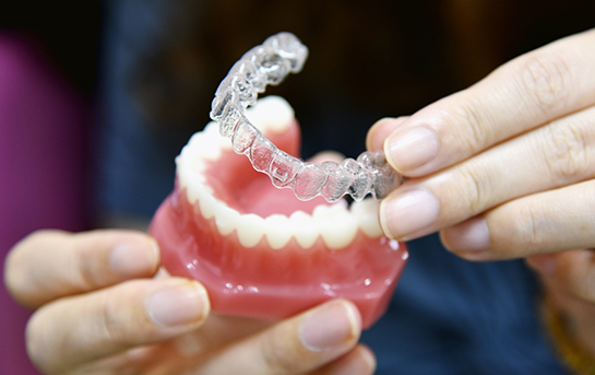 Dentist placing an Invisalign aligner over a model of a row of teeth