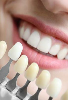 Enhance your smile with cosmetic dentistry near Windermere