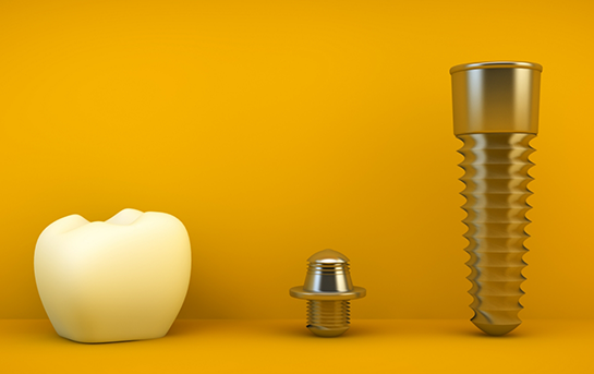 A dental crown a metal implant post and an abutment connector piece