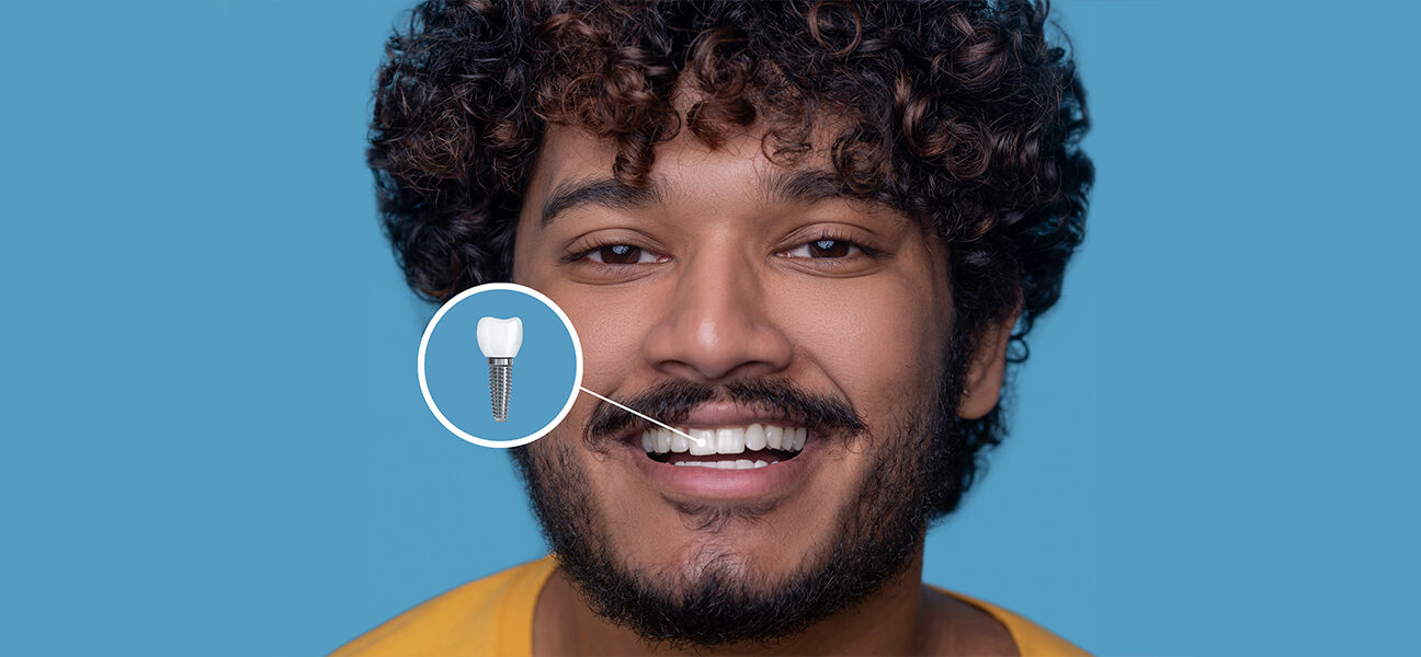 How Dental Implants Can Give You Back Your Smile