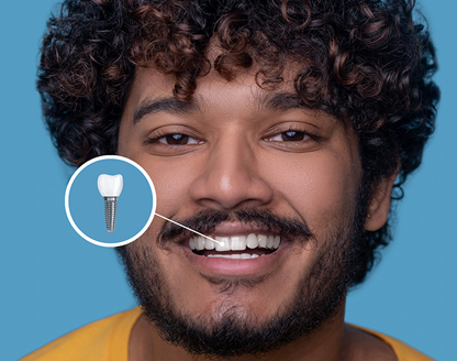 How Dental Implants Can Give You Back Your Smile 