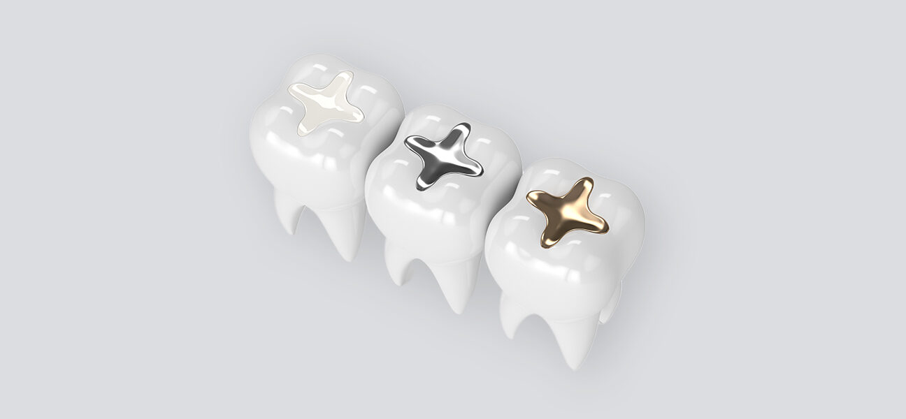 Are Fillings Considered Restorative?