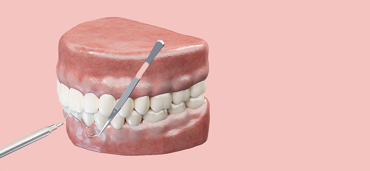 How Successful Are Pinhole Surgical Techniques for Gum Recession?