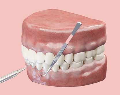 How Successful Are Pinhole Surgical Techniques for Gum Recession? 