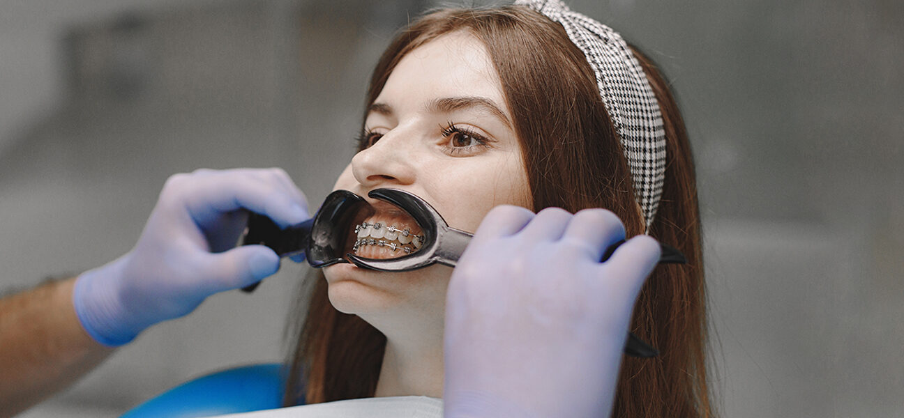 Orthodontic Aftercare: Maintaining Your New Smile for a Lifetime