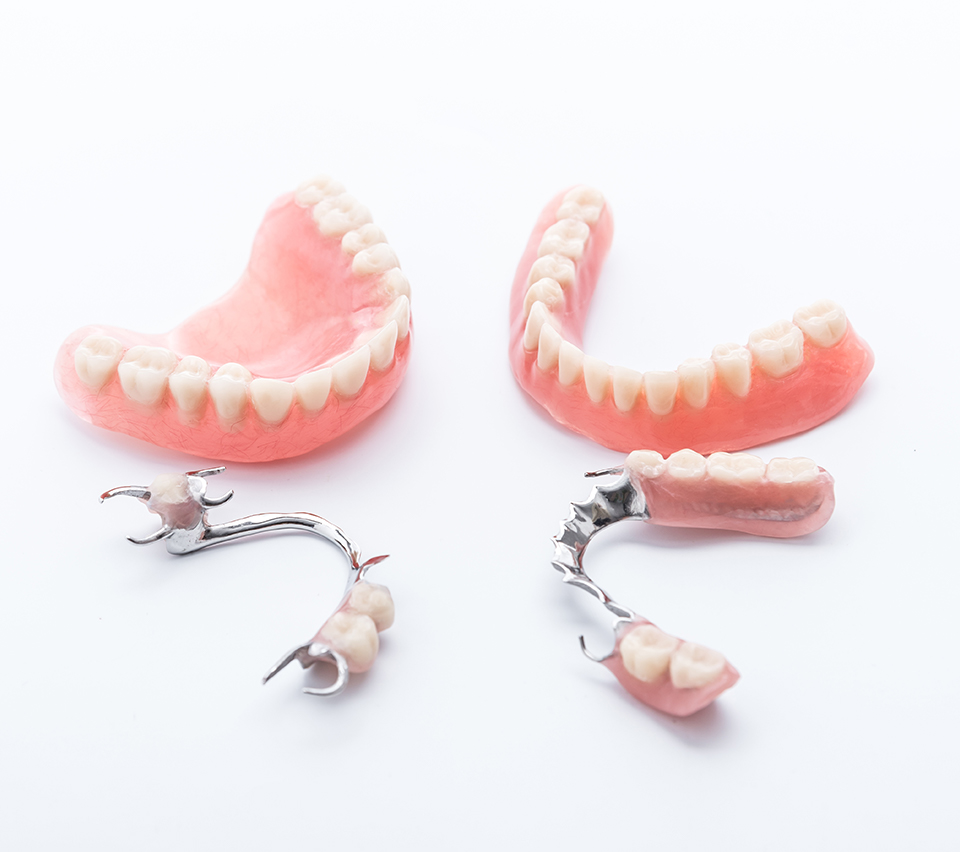 CAST PARTIAL DENTURES