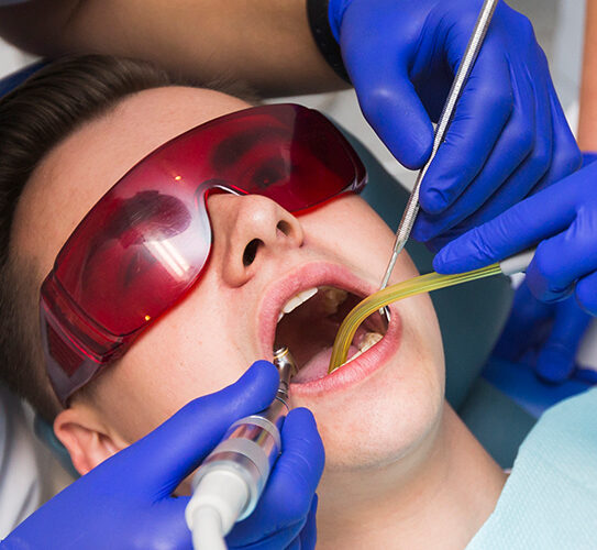 Diode Laser Gingivectomy Treatment