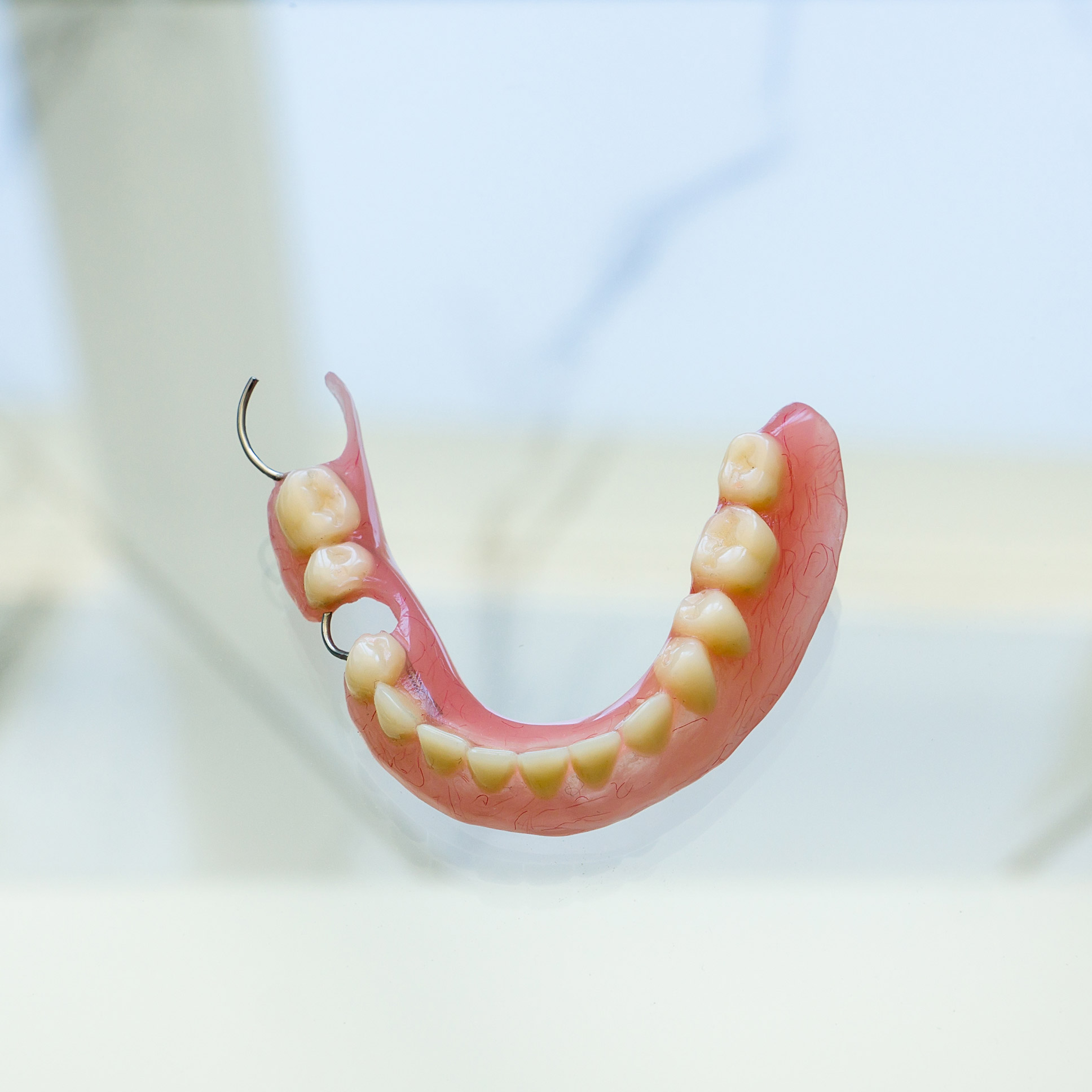 Cast Partial Denture