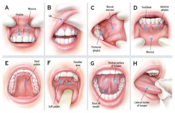 Oral Cancer Screening